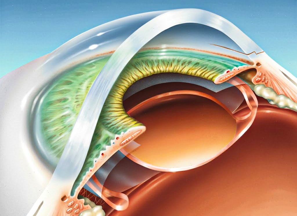 Lens